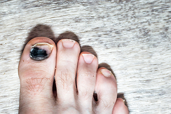 Comprehensive Toenail Problem Guide