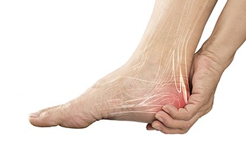 Treating Heel Pain